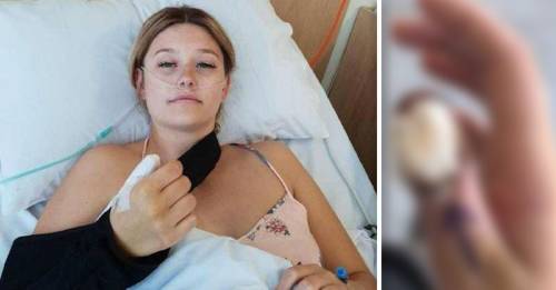 Le amputan el dedo por comerse las uñas: el caso de la joven que dejó al mundo asustado Le amputan el dedo por comerse las uñas: el caso de la joven que dejó al mundo asustado