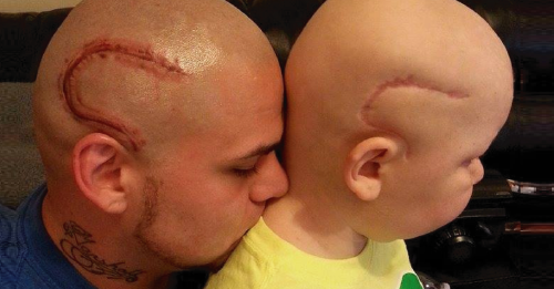 Recuerdas la historia del padre que se tatuó en la cabeza una cicatriz como l..