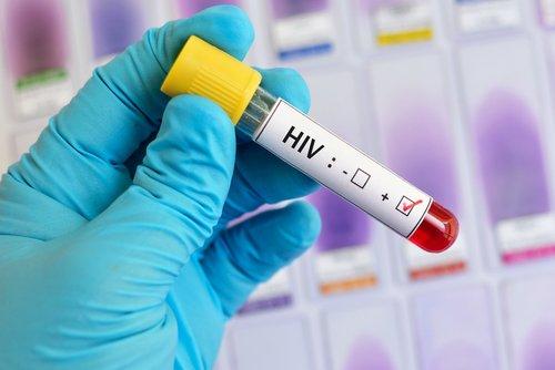 Esta podría ser la primera persona en haberse curado de VIH sin tratamiento