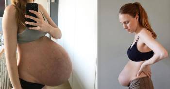 Esta mujer tuvo trillizos y muestra su cuerpo después del parto Esta mujer tuvo trillizos y muestra su cuerpo después del parto