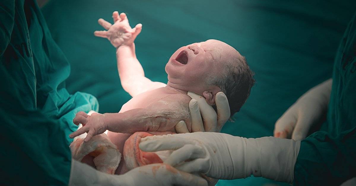 Los nacimientos por cesárea están teniendo un gran impacto en la evolución humana