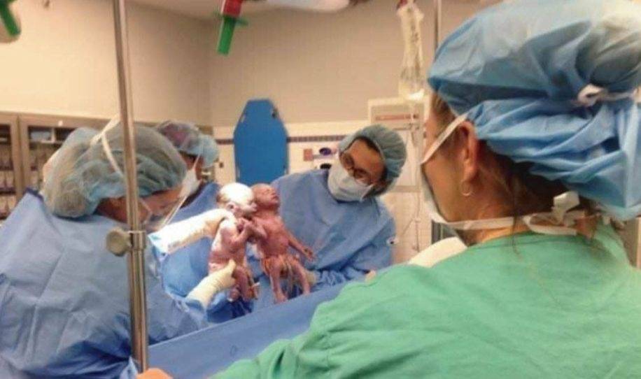 Los médicos lloran, la madre ve a los bebés y comprende lo que está pasando