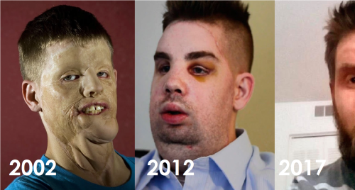 La gente se reía de él, pero en 2012 fue operado y actualmente luce irrecono..