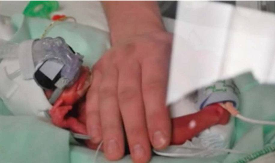 Esta enfermera hizo lo que nadie creyó al ver el sufrimiento de un bebé prem..