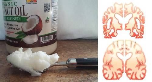 Su cerebro se transformo al beber dos cucharadas de aceite de coco diarias dur..