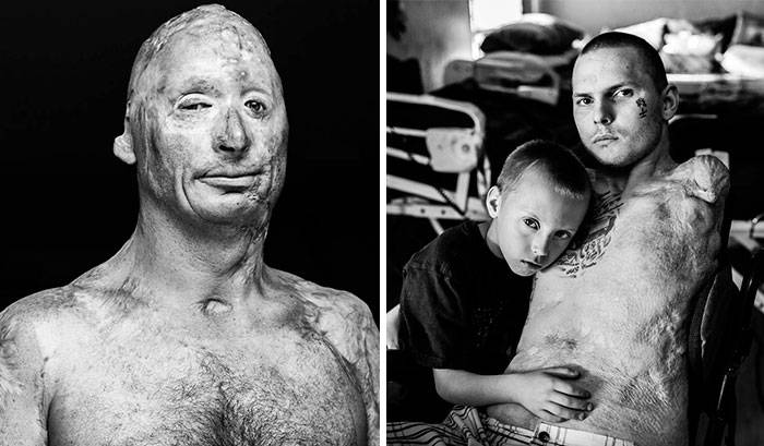 Así es como se ven los veteranos después de años de guerra - impactantes fo..