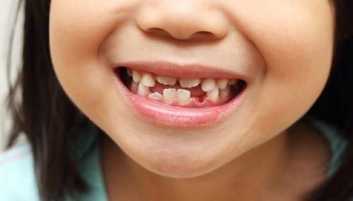 ¿Guardar los dientes de leche puede salvar la vida de tu hijo?
