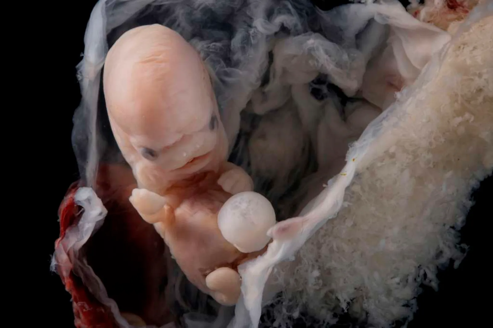 ¿Puede sentir dolor un feto? La pregunta definitiva para despenalizar el aborto o no
