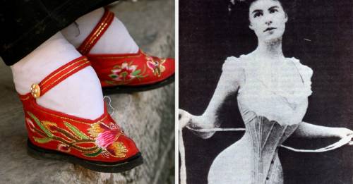 Las 7 tendencias de belleza más peligrosas de la historia Las 7 tendencias de belleza más peligrosas de la historia