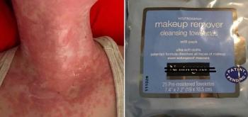 toallitas desmaquillantes toallitas desmaquillantes
