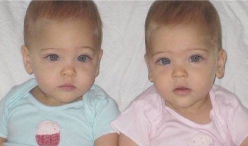 Estas gemelas idénticas ya crecieron y han sido proclamadas "las más hermosa..