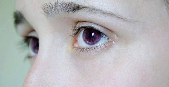 are purple eyes possible