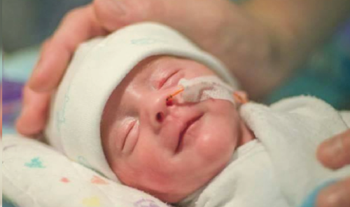 ¡gracias a tus brazos un bebé prematuro puede salvar su vida, averigua de qu..