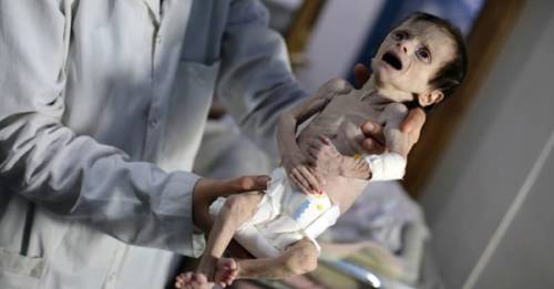 Esta niña murió en siria a causa de la guerra y nos muestra lo que muchos ig..