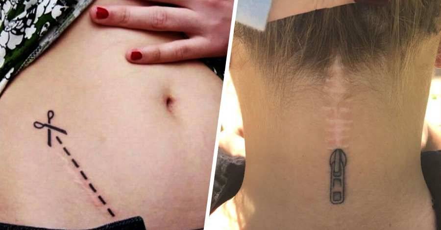 20+ creativos tatuajes que convirtieron cicatrices en obras de arte