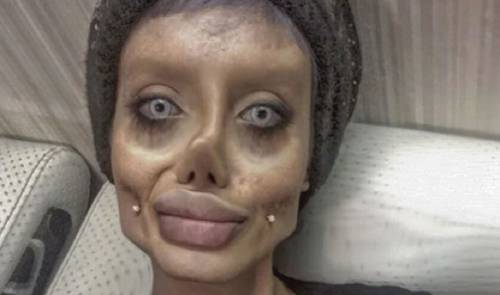 Esta mujer de irán se hizo 50 cirugías para parecerse a angelina jolie