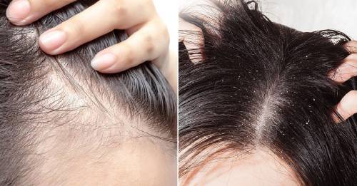 El significado emocional de los problemas del cabello según la Biodescodificación El significado emocional de los problemas del cabello según la Biodescodificación