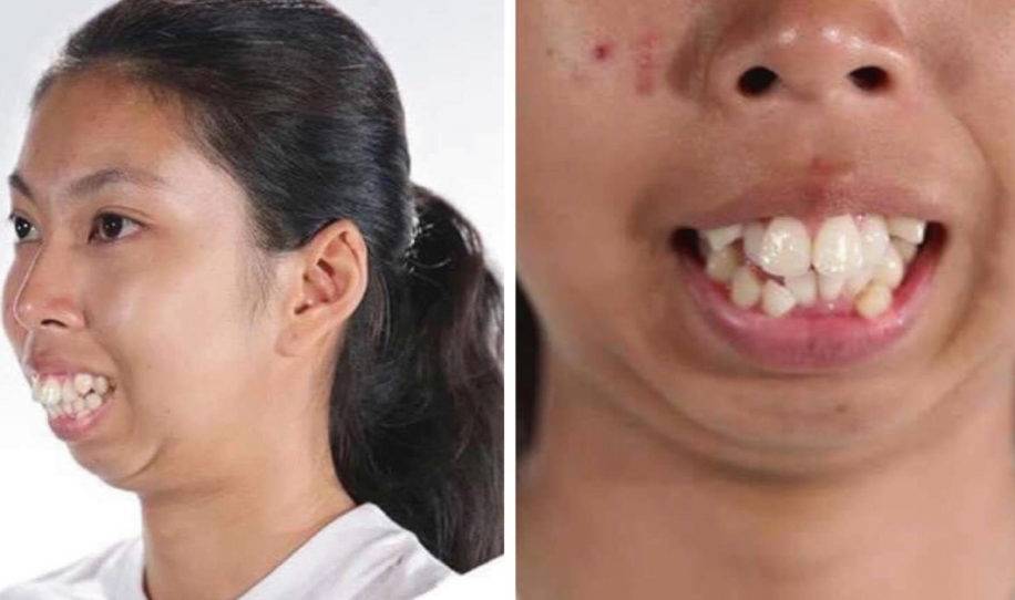 Mujer gana cirugía facial en programa de tv y quedó irreconocible