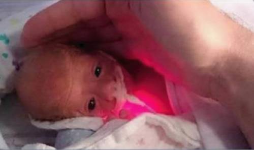 Este increíble luchador de la vida nació con tan sólo 5 meses y pesando med..