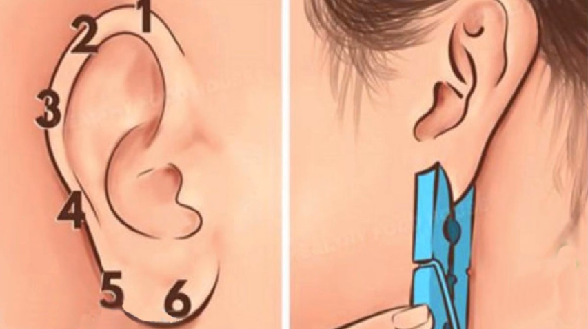 Antes de ir al médico, coloca un broche en tu oreja para aliviar estos dolores